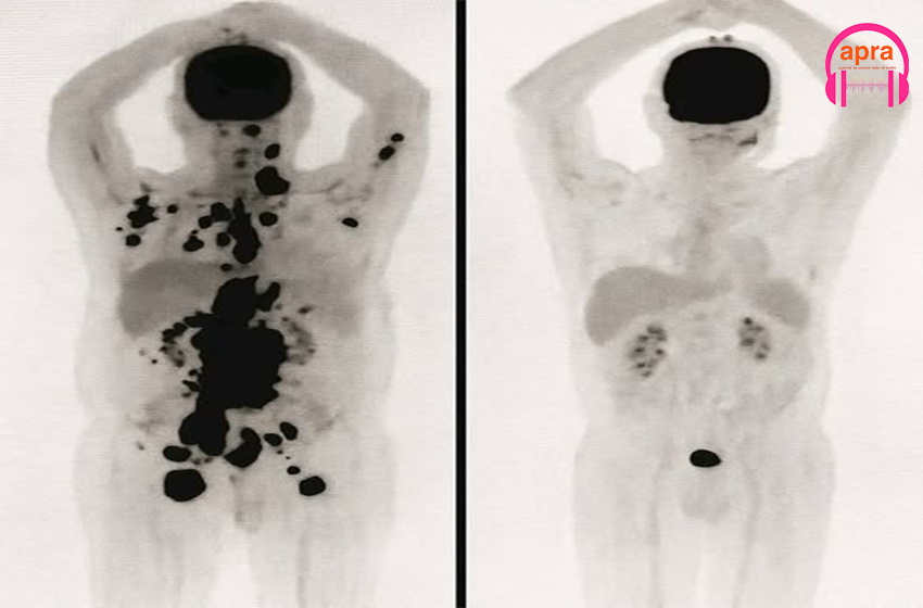 SCIENCE / Corée du Sud : une découverte révolutionnaire pourrait redéfinir la lutte contre le cancer.